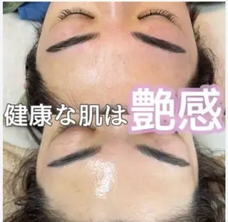 エイジングケアサロンBIOEL所属・肌質改善BIOELプ ラズマ/ラミピールのエステ・リラクイメージ