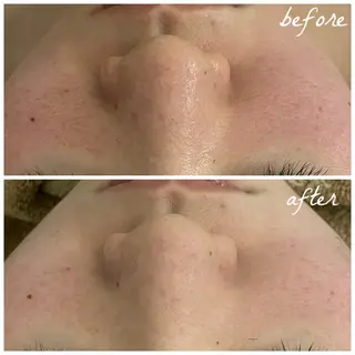 メンズ メナード岐阜茜部 杉浦のエステ・リラクイメージ