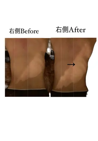 Bon glanzのエステ・リラクイメージ