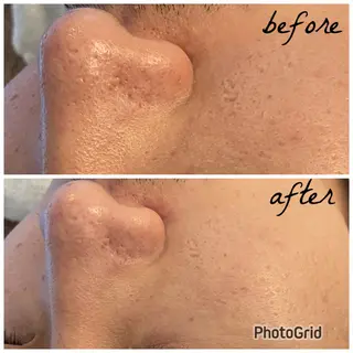 メンズ メナード岐阜市茜部 杉浦のエステ・リラクイメージ