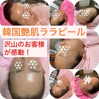韓国肌&ララピール シミケア　せんすのエステ・リラクイメージ