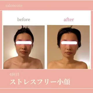 stress care salon　海と猫所属・小顔salon 古田琴のエステ・リラクイメージ