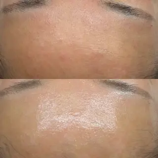 韓国🇰🇷価格 サロン_Nbibiのエステ・リラクイメージ