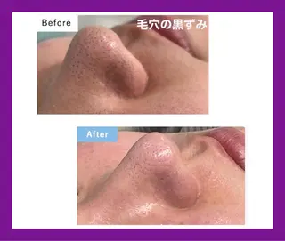 オーガニック エステ サロンフィオーレの眉毛・アイブロウイメージ