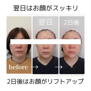 小顔と ヘッドスパのお店のエステ・リラクイメージ