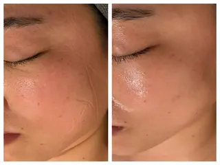 小顔＆まつ毛サロン AKANE❤️のエステ・リラクイメージ