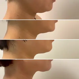 スキンケアサロン　デディア所属・米谷🎀 デディア恵比寿🪞✨のエステ・リラクイメージ