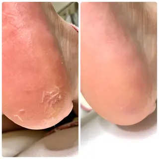 ネイル ⭐️遠藤 夏純⭐️のエステ・リラクイメージ