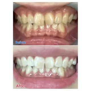 M渋谷店所属・M渋谷 ホワイトニングのエステ・リラクイメージ