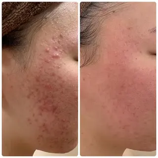 レイビス名古屋♡ 川北のエステ・リラクイメージ