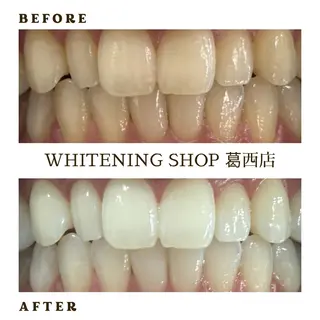 メンズ ホワイトニング ショップ葛西店のその他イメージ