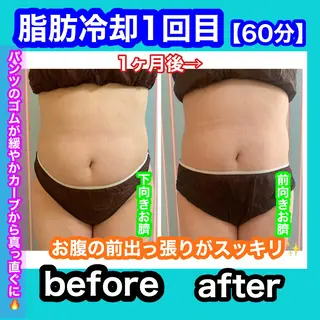 痩身/脱毛/ネイル HARUKAのエステ・リラクイメージ