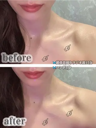 LAGRECE 大阪梅田店のエステ・リラクイメージ