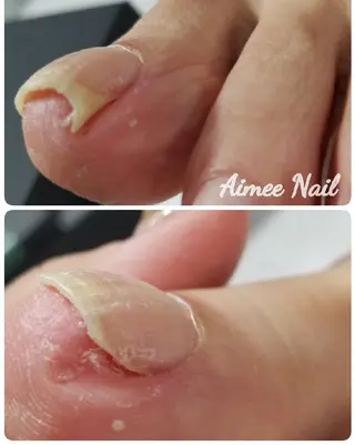 ネイル 齋藤 あゆみのネイルデザイン