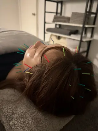 美容鍼×小顔矯正 ×美容整体　浜川泰仁のエステ・リラクイメージ