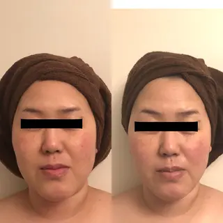 おうちサロン B-ROOMのエステ・リラクイメージ