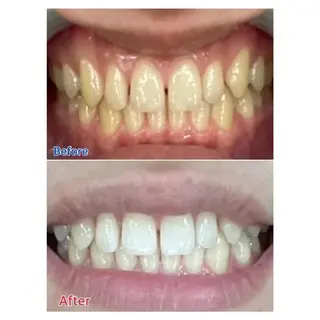 M渋谷店所属・Ｍ渋谷 ホワイトニングのエステ・リラクイメージ