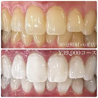 PLATINUM Beauty 横浜店所属・ホワイトニングルーム 横浜店のその他イメージ