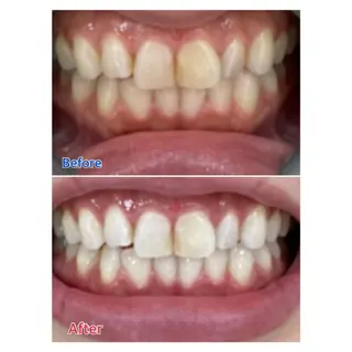 MBEAUTYSALON 千葉店・京成大久保所属・Melty 輝のその他イメージ