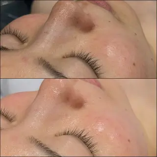 LiZA エステティックサロンのエステ・リラクイメージ