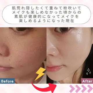 痩身ハーブピーリング 筋膜リリース☆B&Hのエステ・リラクイメージ