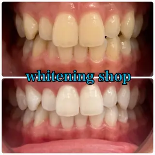 メンズ ホワイトニング ショップ川越店のエステ・リラクイメージ