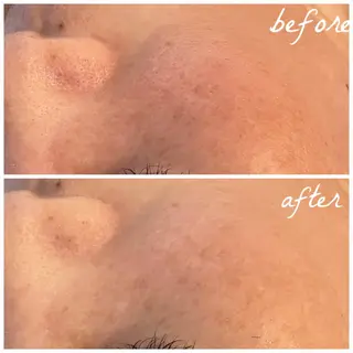 メンズ メナード岐阜市茜部 杉浦のエステ・リラクイメージ