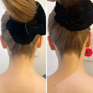 うなじ脱毛/美肌脱毛 LABELのエステ・リラクイメージ