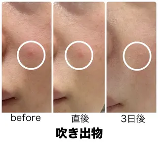 leolo武蔵浦和 肌質改善＆脱毛のエステ・リラクイメージ