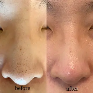 毛穴専門サロン　フルール所属・フルールFululu 自由が丘のエステ・リラクイメージ