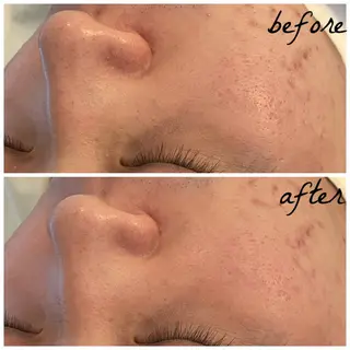 メンズ メナード岐阜市茜部 杉浦のエステ・リラクイメージ