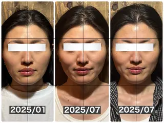 💎後悔させない小顔 矯正💎イトヤマ🌱のエステ・リラクイメージ