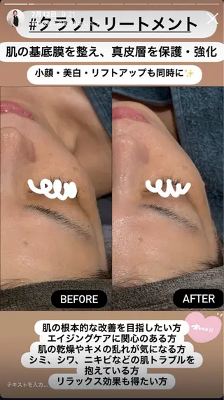 LiZA エステティックサロンのエステ・リラクイメージ