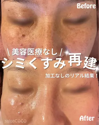 salonCOCO所属・素肌再建看護師💎 salonCOCOのエステ・リラクイメージ