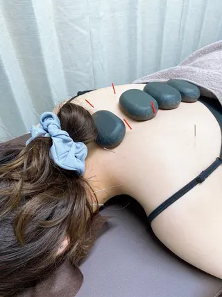 美容鍼・小顔矯正 ハリシェンドのエステ・リラクイメージ