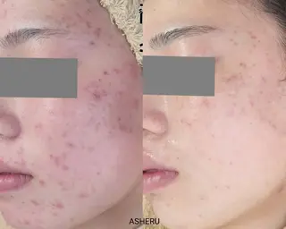 ASHERU* Yuiのエステ・リラクイメージ