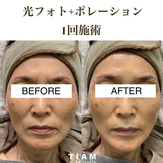 美肌サロンTIAM by tetoteのエステ・リラクイメージ