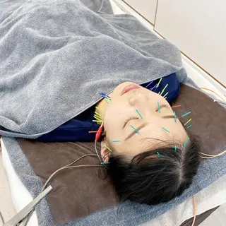 はり灸サロン totonoi所属・印象の良くなる 美容鍼のエステ・リラクイメージ