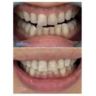 M渋谷店所属・M渋谷 ホワイトニングのエステ・リラクイメージ