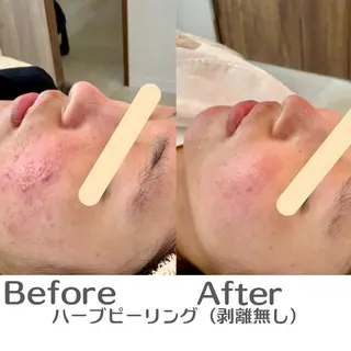 最速小顔・肌質管理 espoirマキのエステ・リラクイメージ