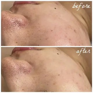 メンズ メナード岐阜市茜部 杉浦のエステ・リラクイメージ