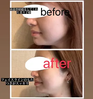 ペルルクィーン所属・ペルル． クィーンのエステ・リラクイメージ