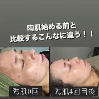 salonOFF〜脱毛•美肌〜所属・【医療提携サロン】 OFF〜脱毛＆美肌〜のエステ・リラクイメージ