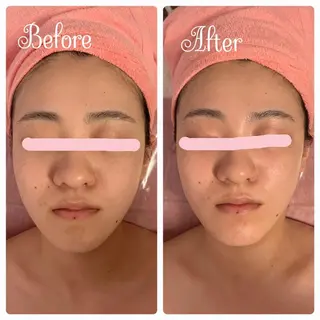 透明感の肌Lino malieのエステ・リラクイメージ