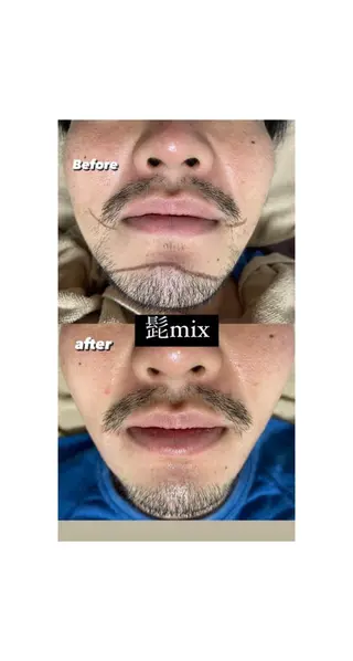 ショート Epina 千葉店 【エピナ】のエステ・リラクイメージ