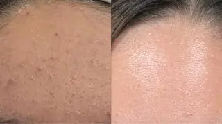 ナリス ビューティーステーション デ・アイム 有田所属・西谷 ゆめのエステ・リラクイメージ