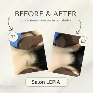 男女同額脱毛エステ salonLEPIAのエステ・リラクイメージ