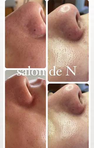 salon de Nのエステ・リラクイメージ