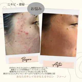 フェイシャルワックス 自然派エステファーノのその他イメージ