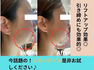 Beautysalonプルメリア所属・エステ プルメリアのエステ・リラクイメージ